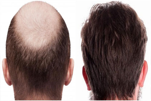 Looks Hair Studio Vijayawada